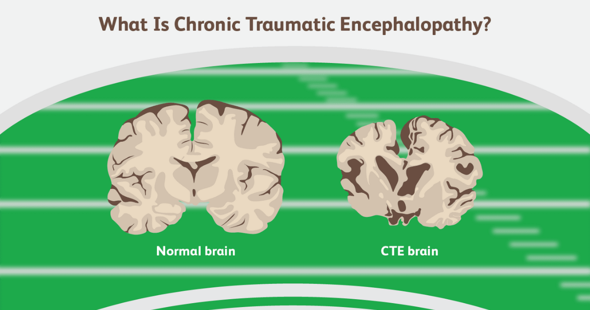 What Is CTE and its Stages?